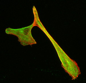 Microscopie confocale