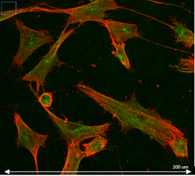 Imagerie microscopie confocale