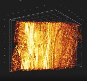 Imagerie microscopie à feuille de lumière