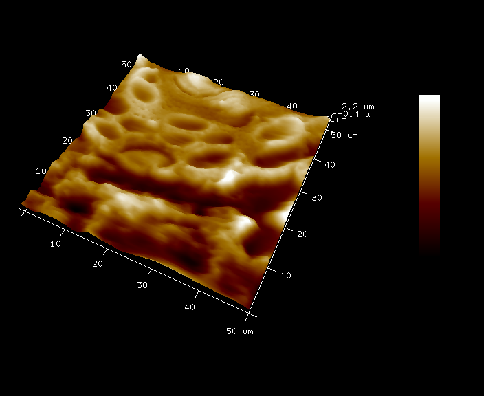AFM topographic image of skin from abdominoplasty, highlighting the main skin compartments