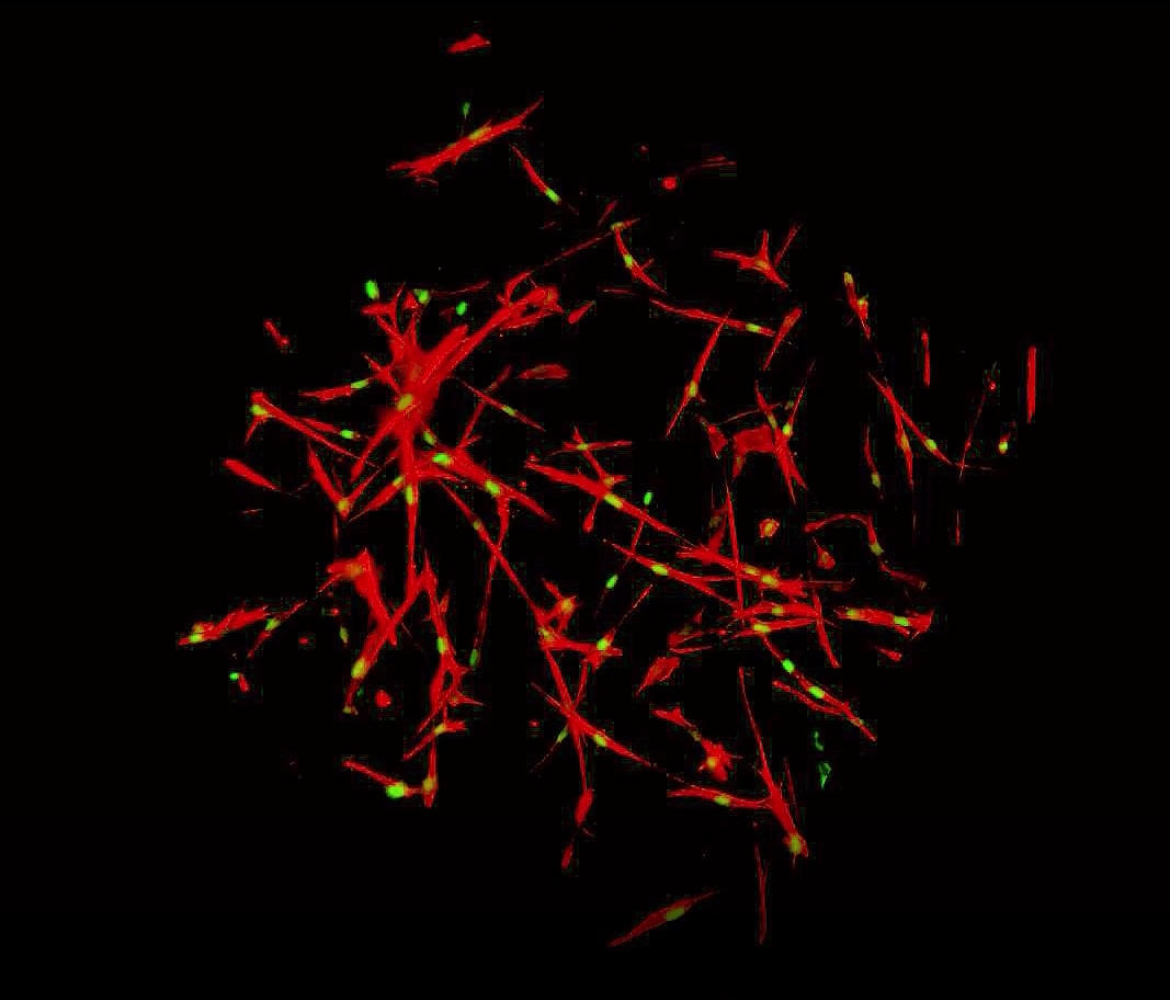 culture of fibroblasts in collagen discs, allowing the culture of fibroblasts in a three dimensional system, alternative to the classical two dimensional culture system