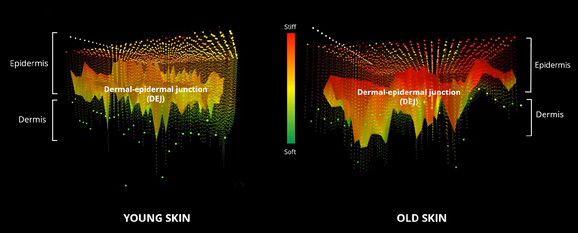 3D force map of dermal-epidermal junction (DEJ) evolution over time with Atomic Force Microscopy (AFM)