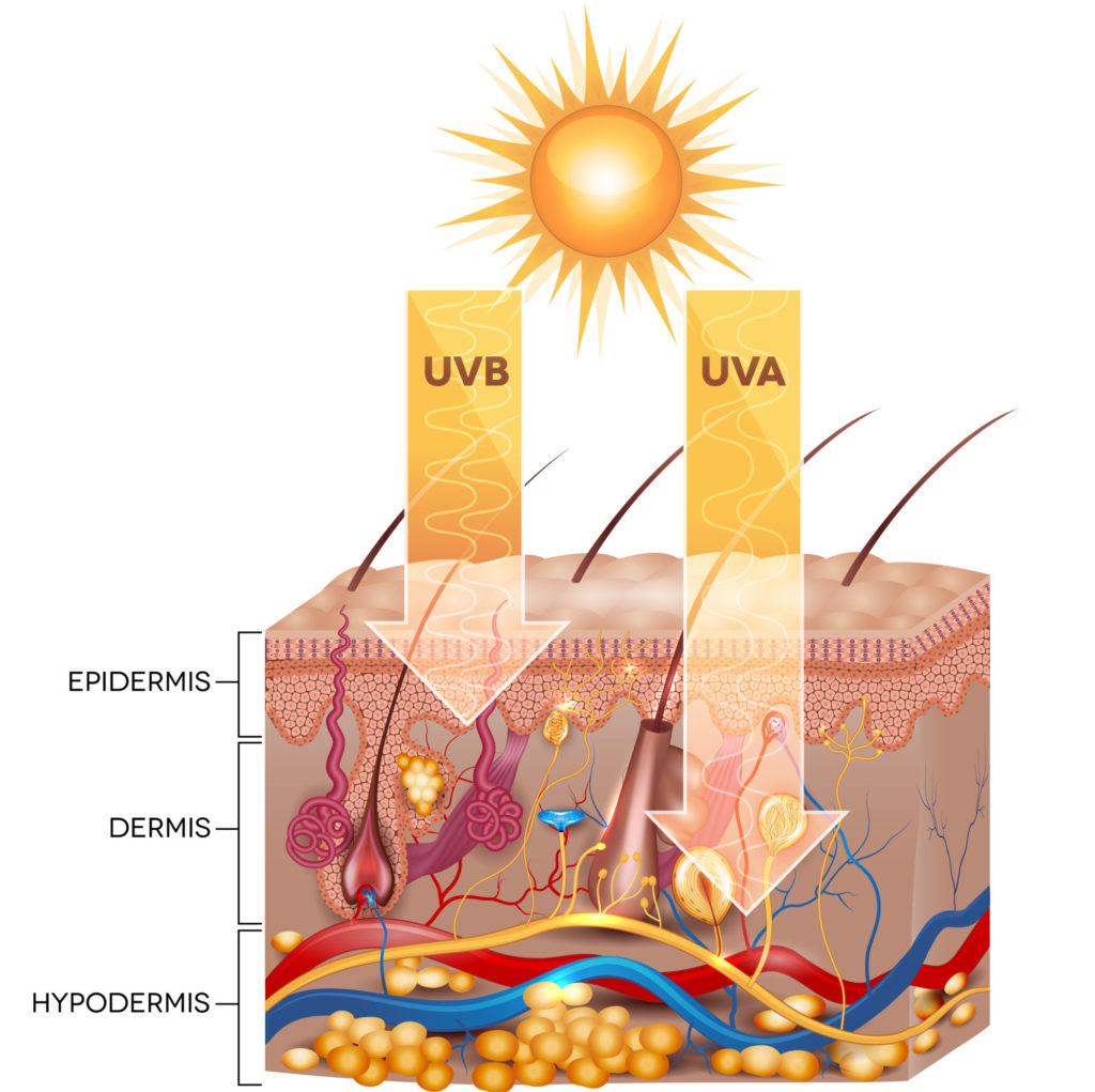 UV impact